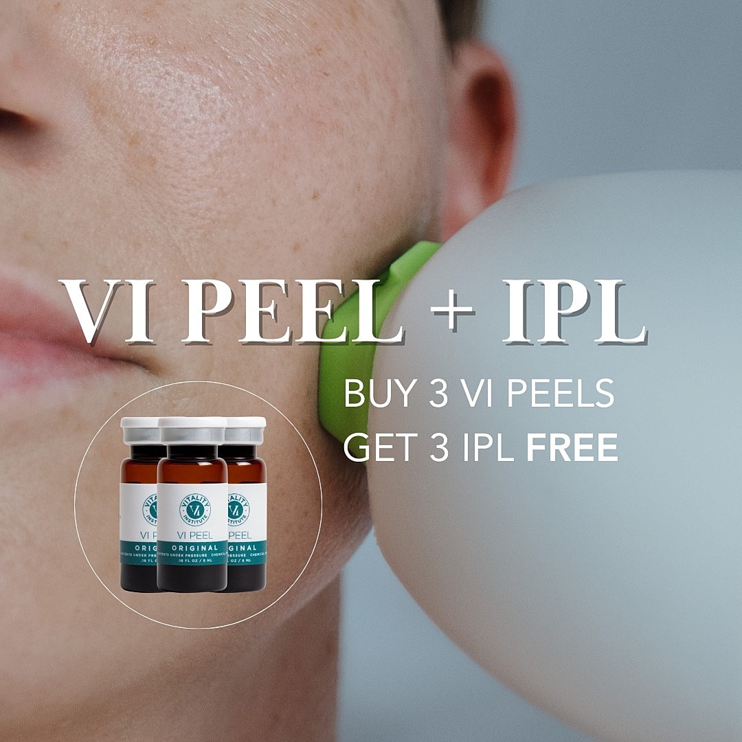 VI Peel promotion with IPL offer displayed.