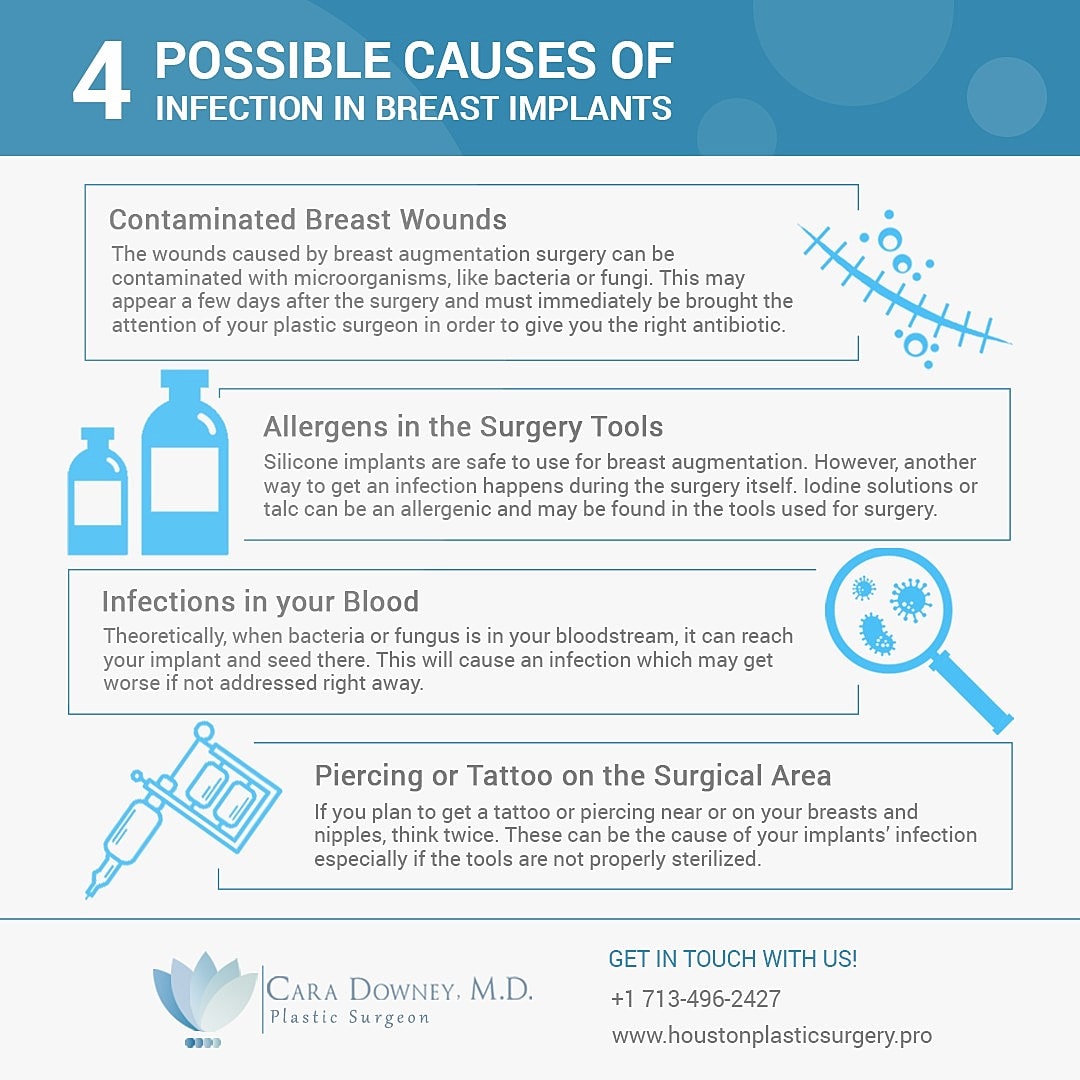 4 Causes of Breast Implant Infection