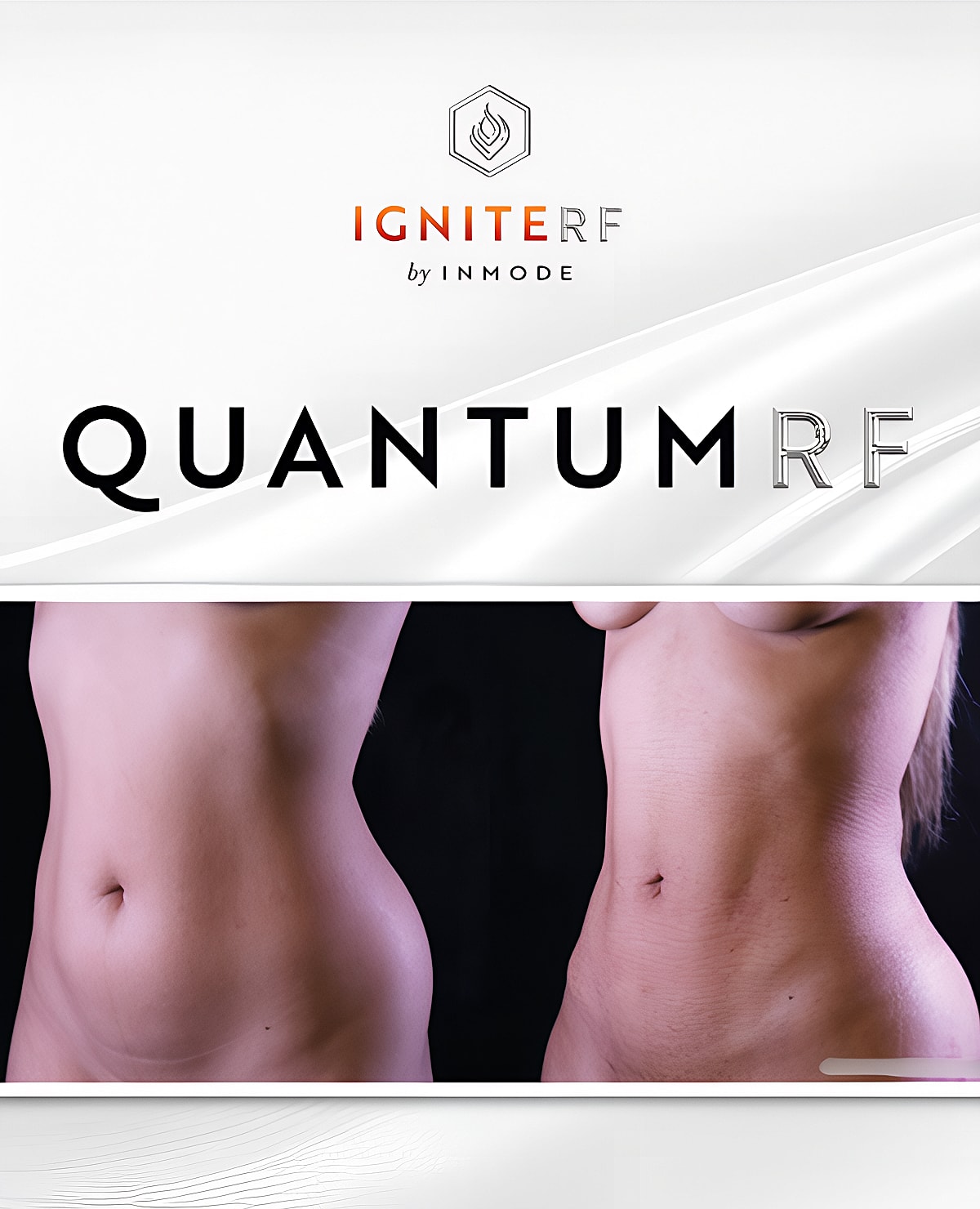 Before and after body contouring treatment.