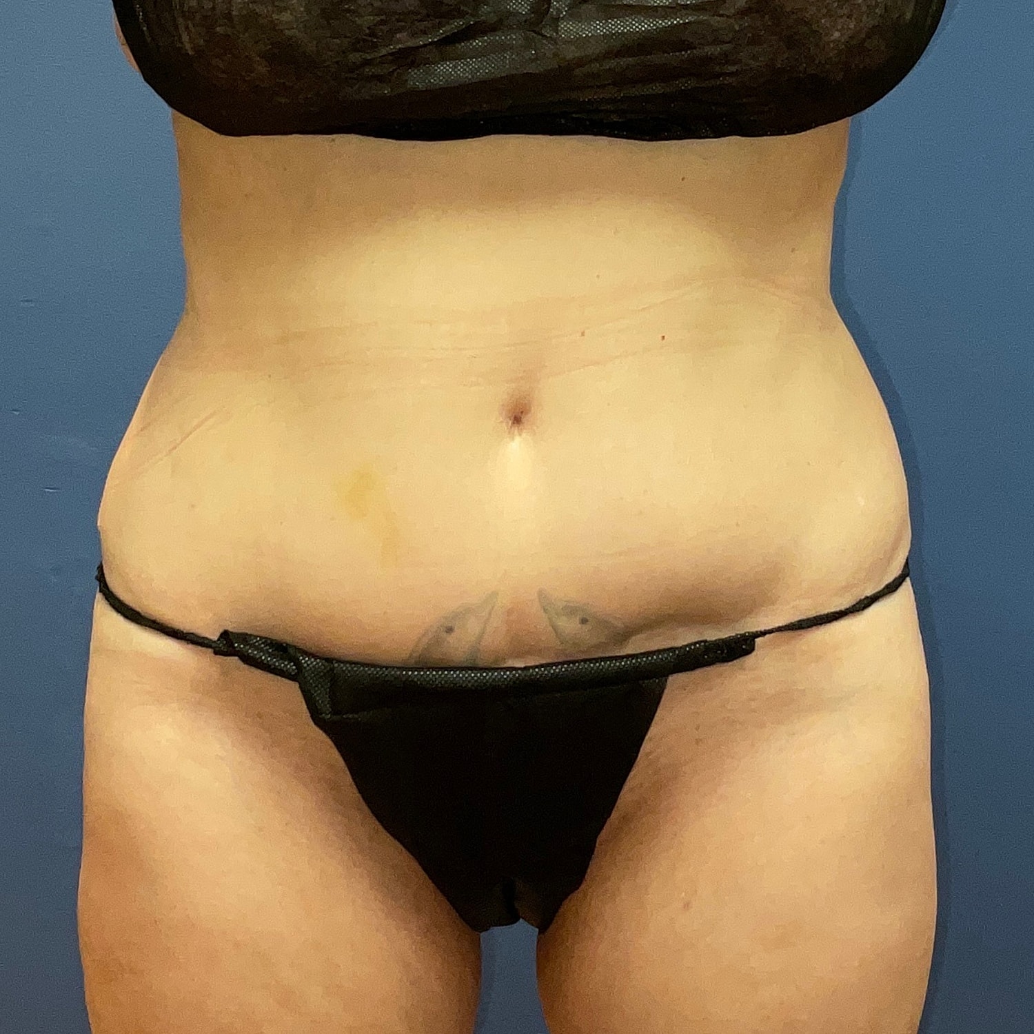 Medical Weight Loss Gallery Before & After