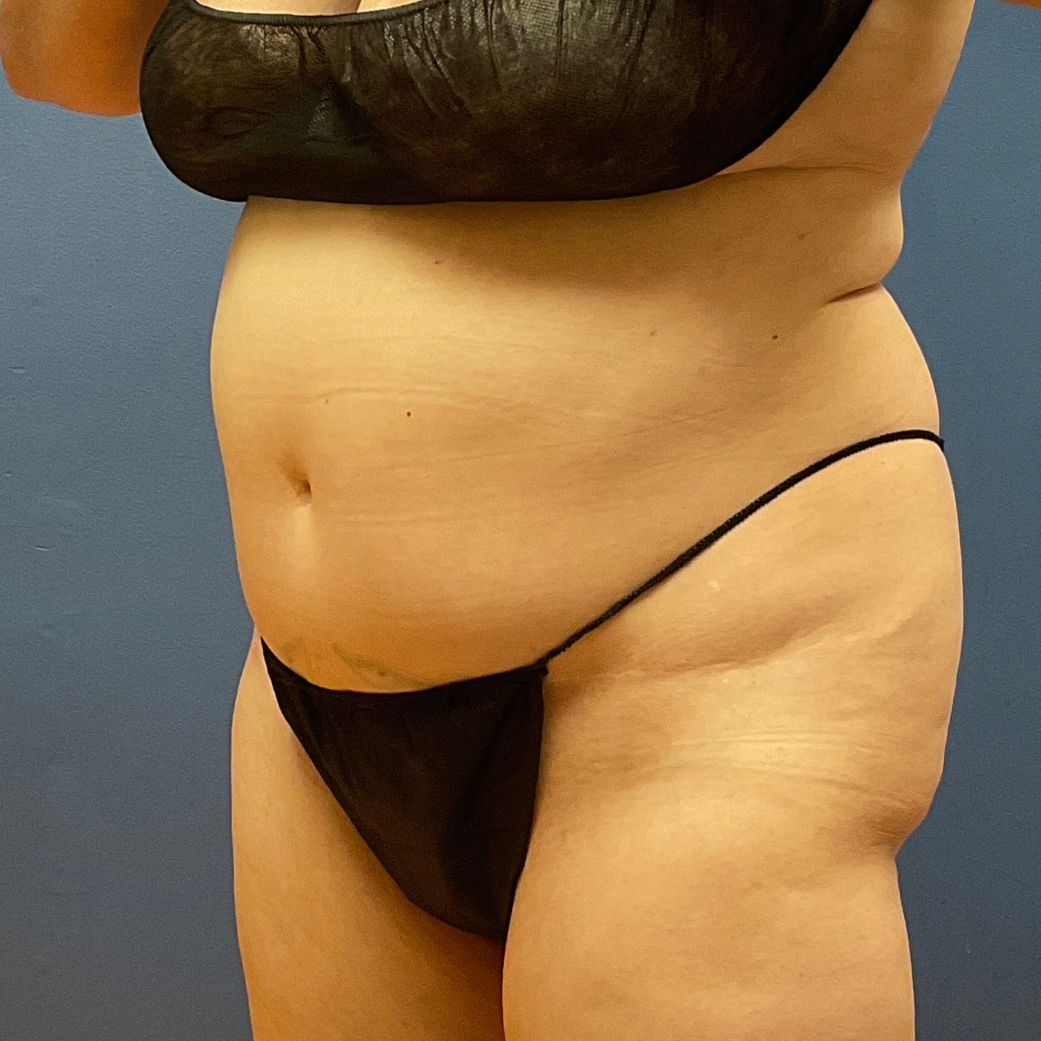 Medical Weight Loss Gallery Before & After