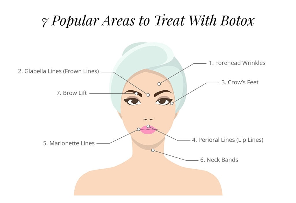7 popular areas to treat with botox graphic