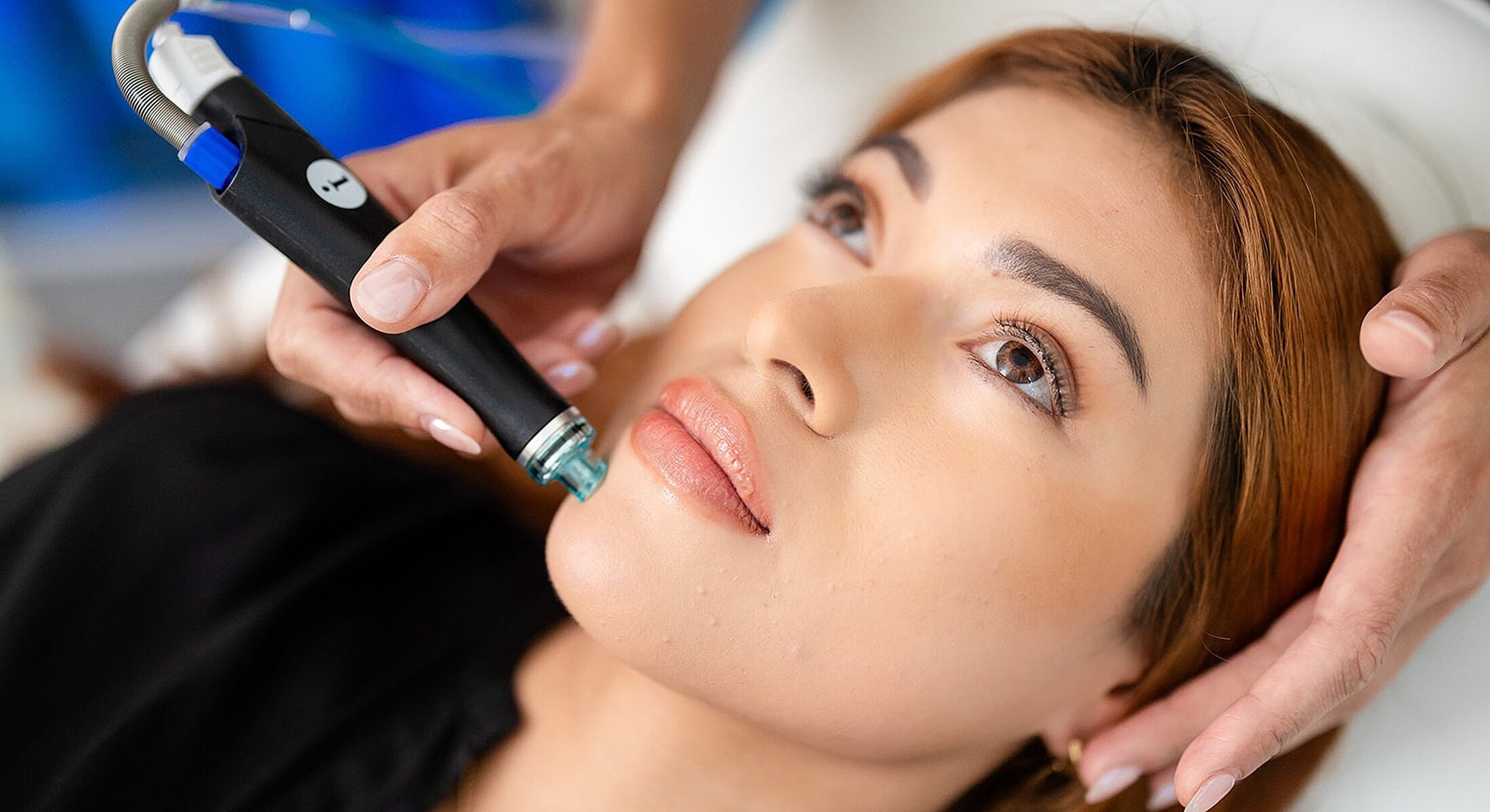 Skin treatment using a microneedling device.