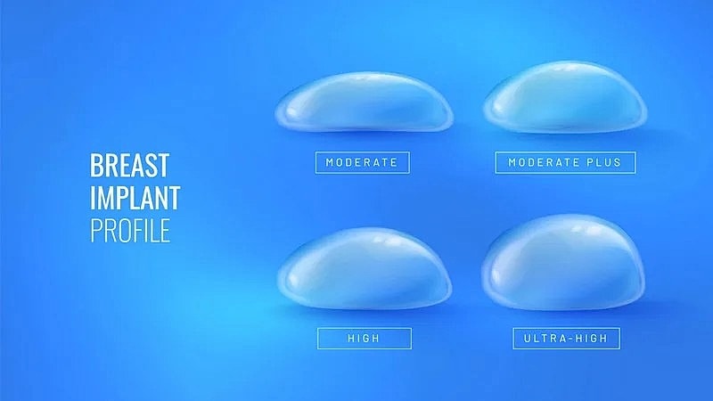 Breast implant profile options and classifications.