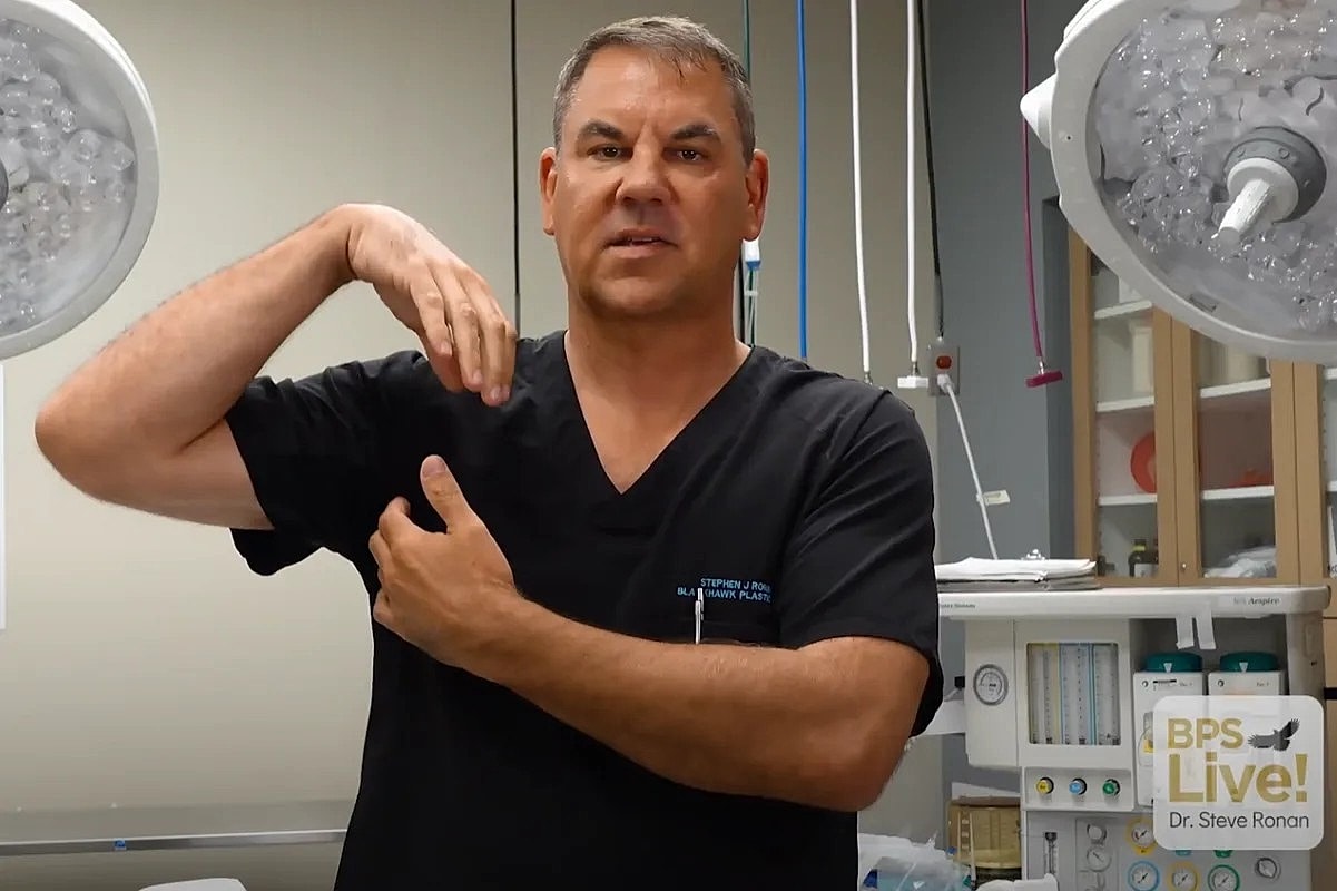 Doctor demonstrating arm movement in surgical setting.
