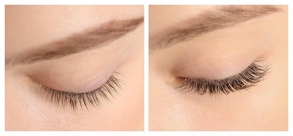 Achieve Longer, More Luscious Lashes with Latisse Lash Serum