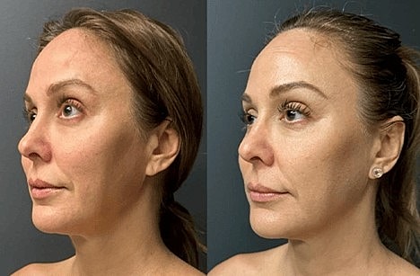 Discover the Best Skin Resurfacing Treatments in Scottsdale! - Image 7