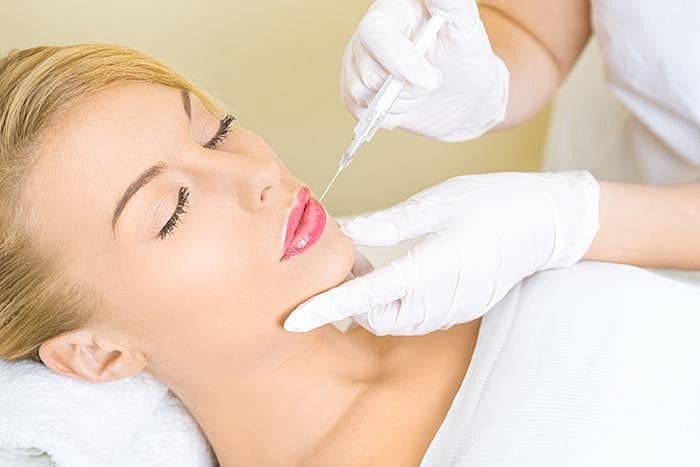 Discover Why Everyone Is Raving About Bellafill, the Dermal Filler With Results That Last 5 Years