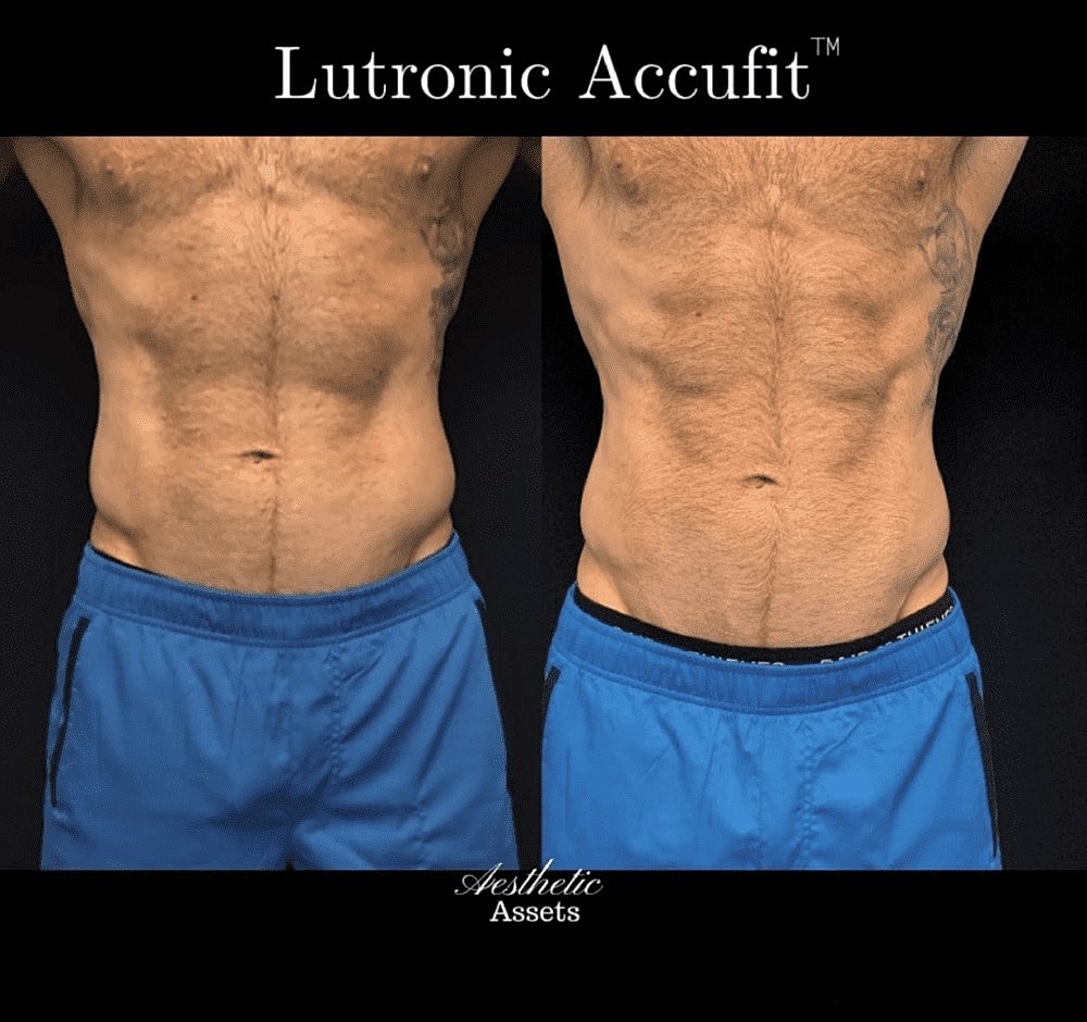 Get Your Dream Body With Accufit