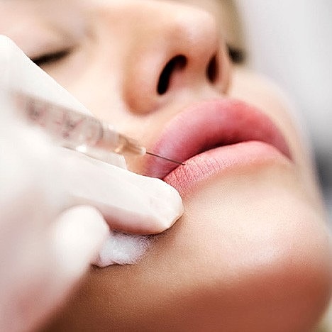 How Long Do Dermal Fillers Last?