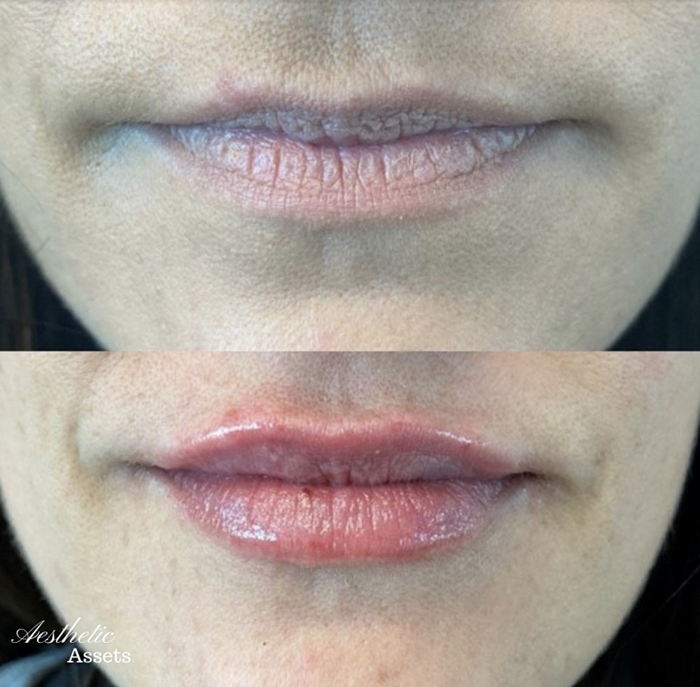 Kissie, Kissie Luscious Lippies - Image 3