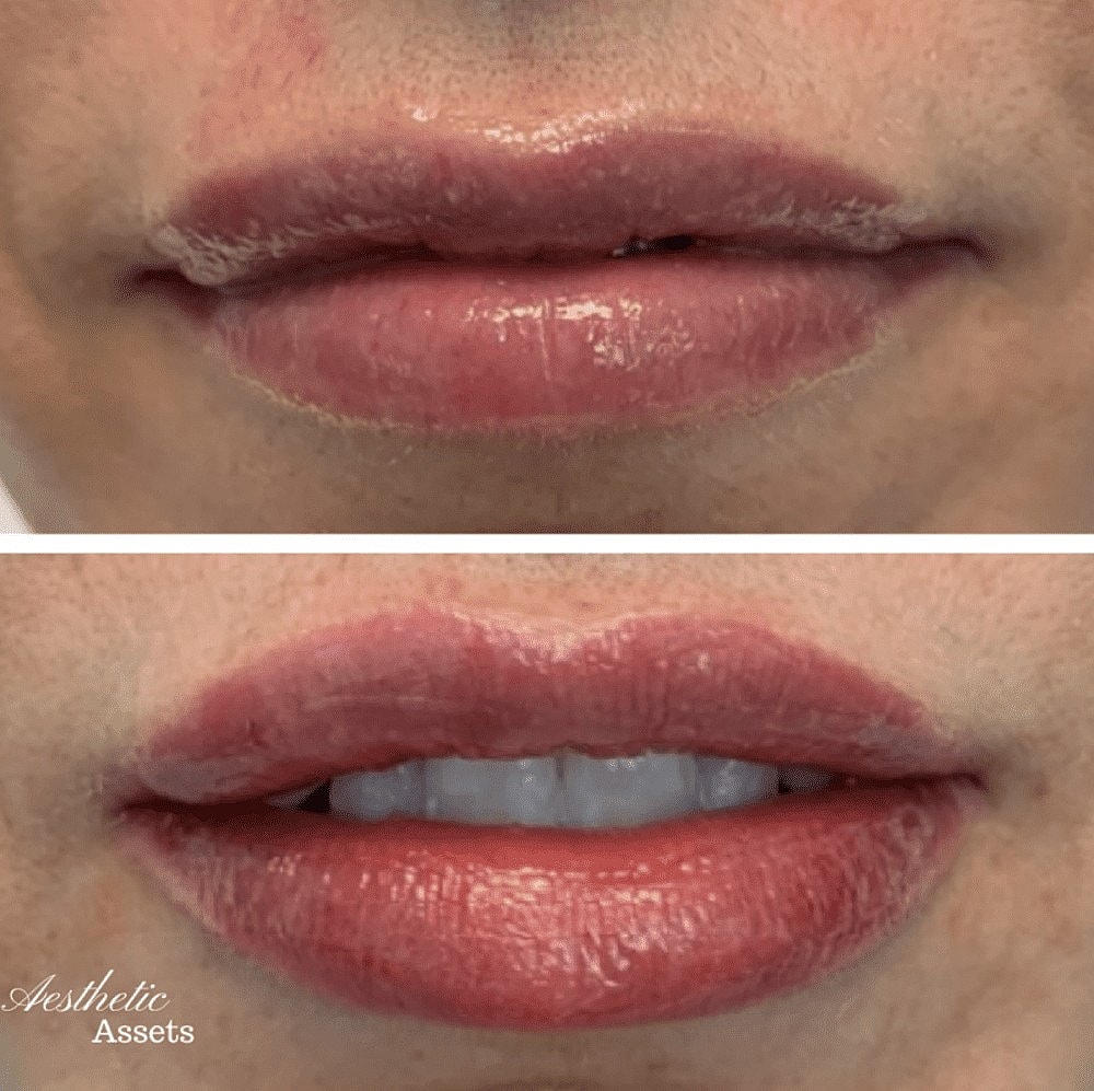 Kissie, Kissie Luscious Lippies - Image 4