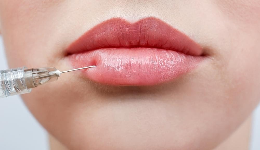 Kissie, Kissie Luscious Lippies