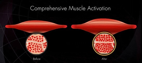Next Level in Body Sculpting with Lutronic Accufit™ - Image 3