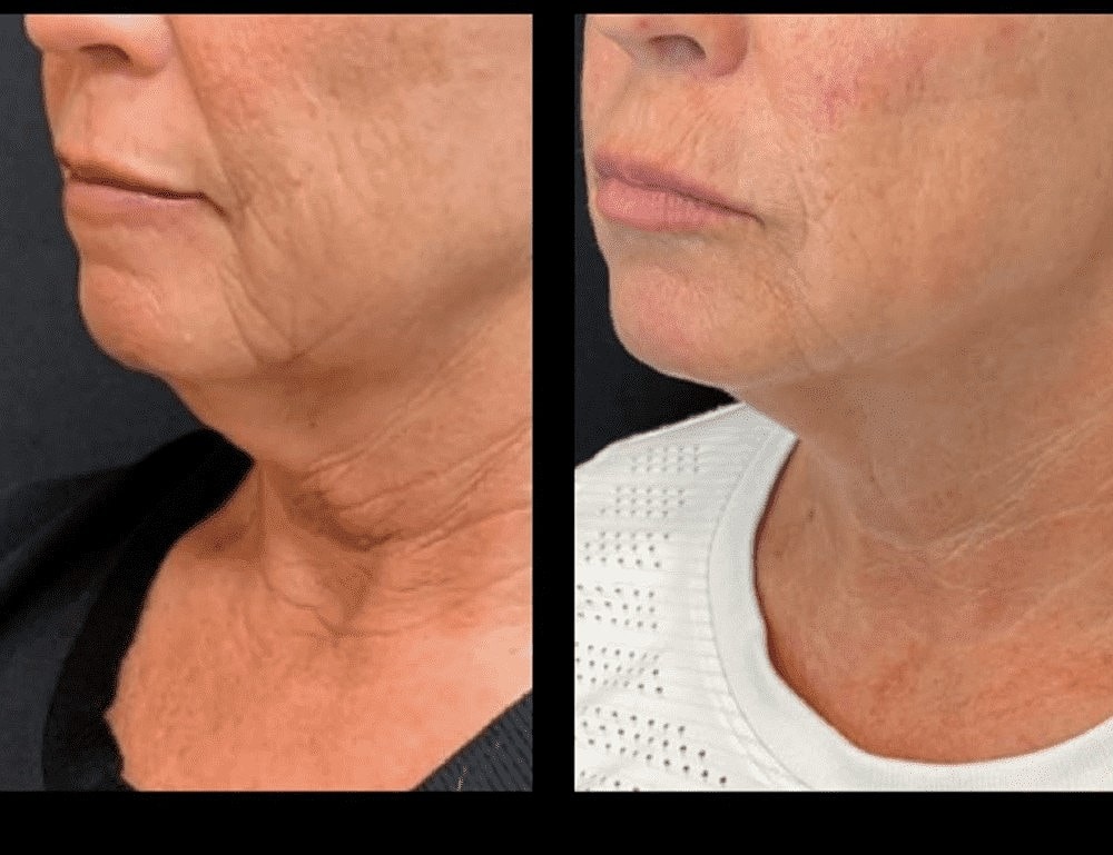 Put Your Best Face Forward This Year With The Total Skin Solution by Lutronic - Image 3