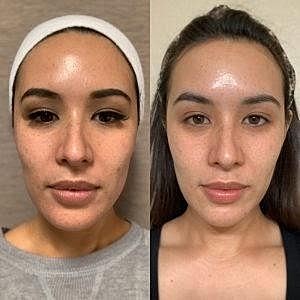 Put Your Best Face Forward With Our Breakout-Buster Regimen - Image 3