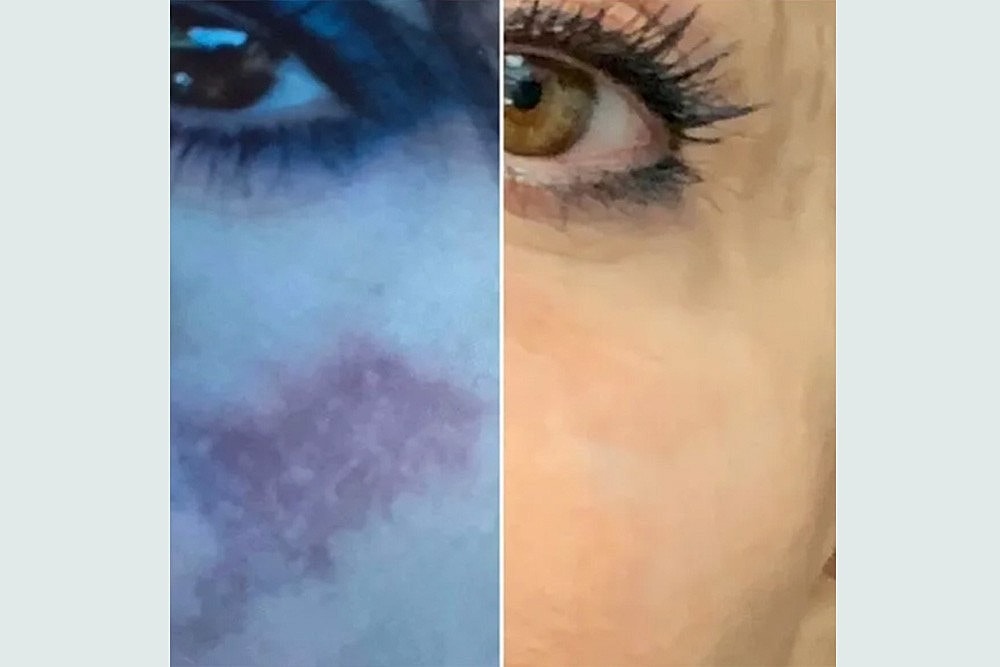 RESURFACE LAST YEAR AWAY NEW YEAR BETTER SKIN - Image 10