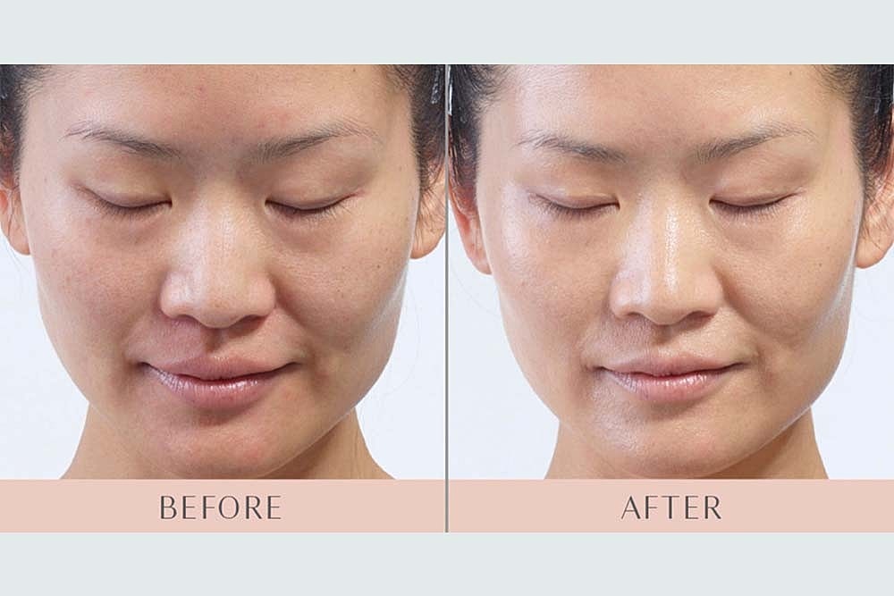 RESURFACE LAST YEAR AWAY NEW YEAR BETTER SKIN - Image 2