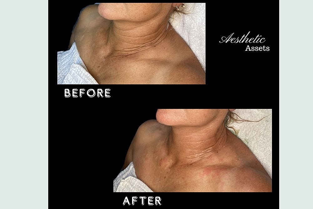 RESURFACE LAST YEAR AWAY NEW YEAR BETTER SKIN - Image 5