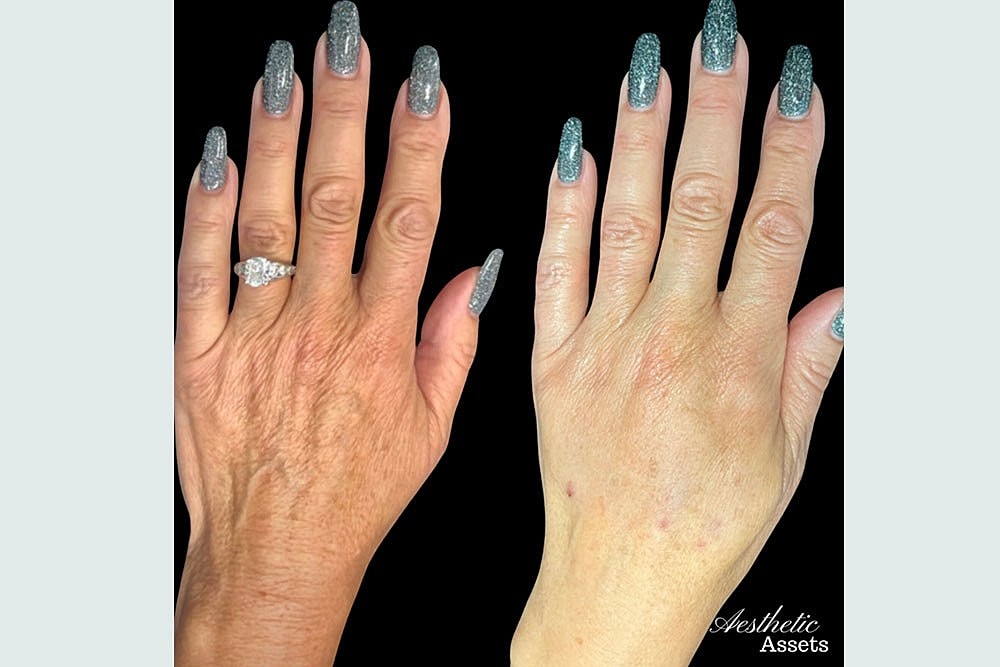 RESURFACE LAST YEAR AWAY NEW YEAR BETTER SKIN - Image 8