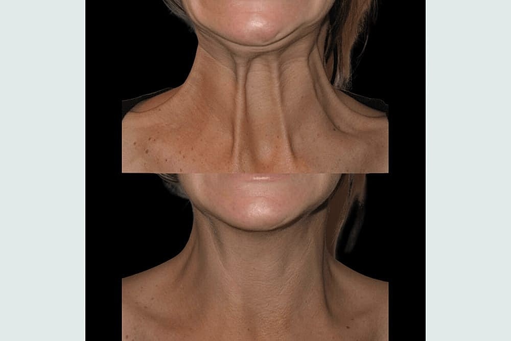 Take The Wobble Out of Your Gobble - Image 3
