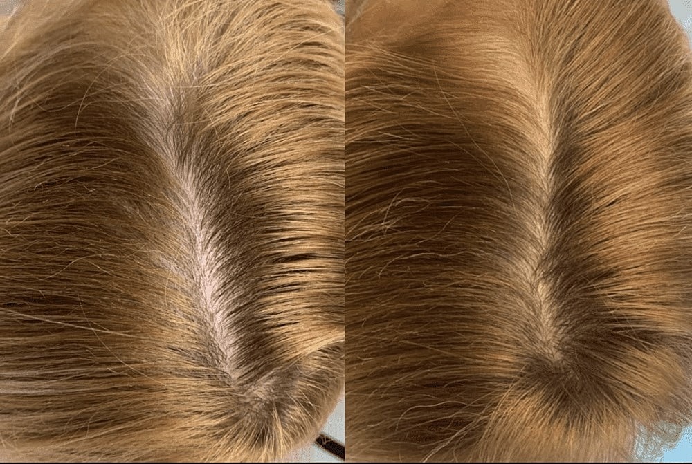 hair
