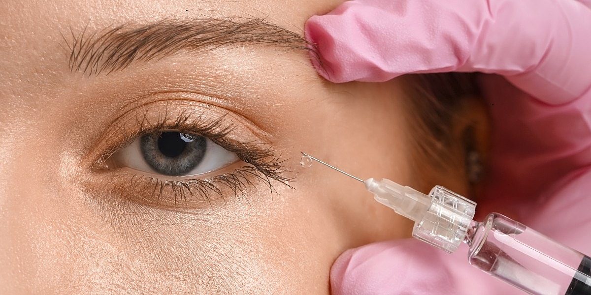 How Under-Eye Filler Works