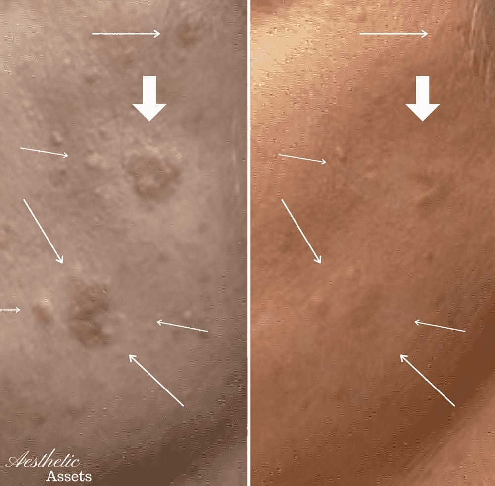 What Are My Options for Brightening My Skin? - Image 2