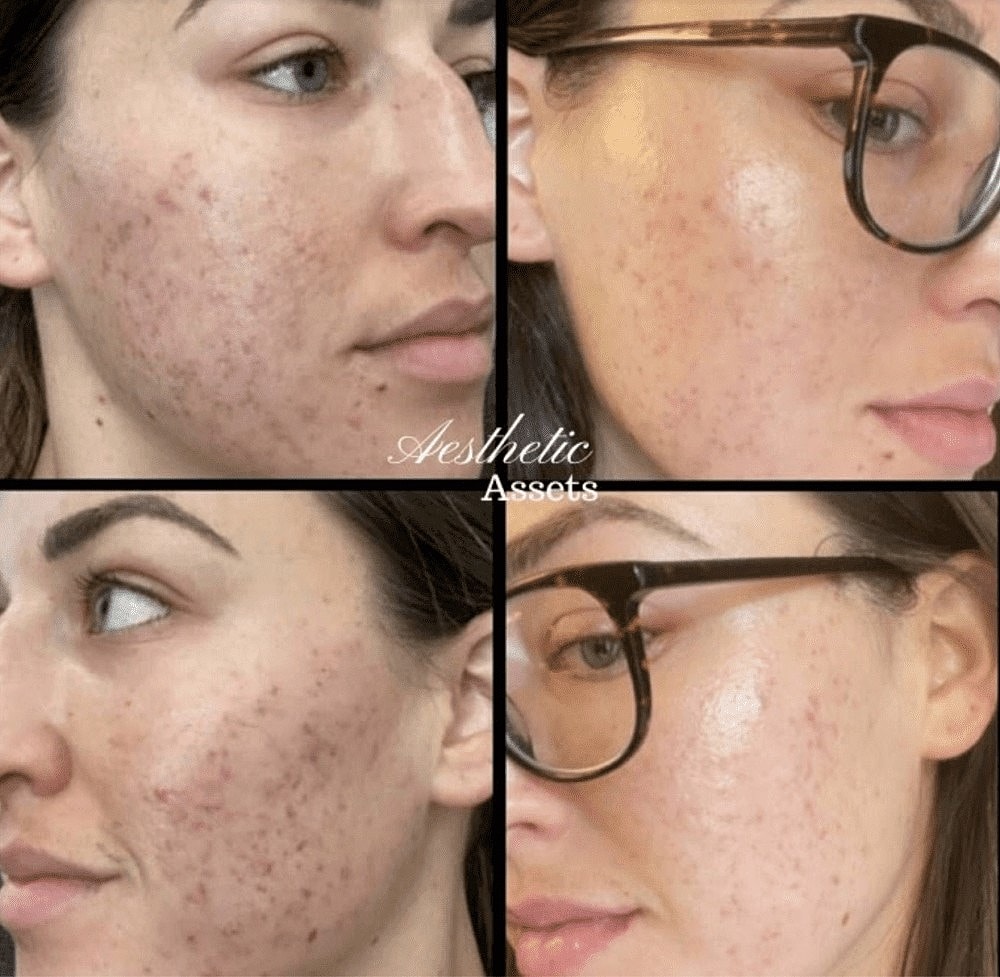 What Are My Options for Brightening My Skin? - Image 3