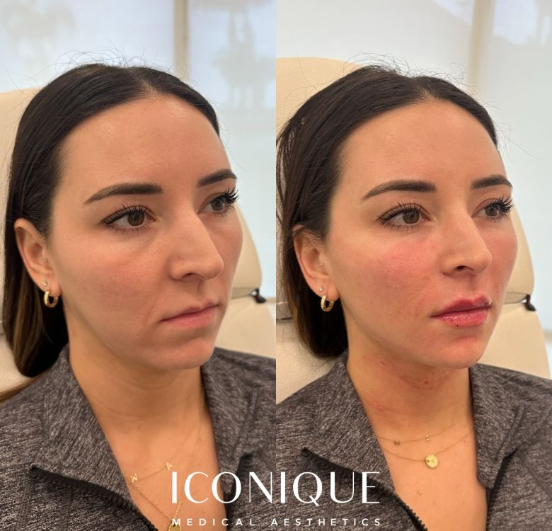 Before and after facial aesthetic treatment results.