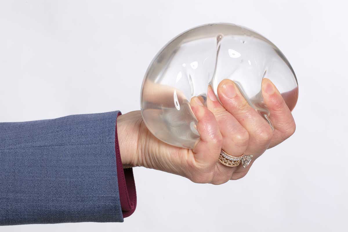 Breast implant modal