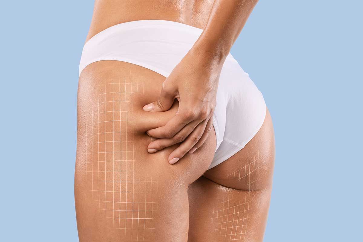 Liposuction treatments at Judith Gurley Plastic Surgery & Medical Spa
