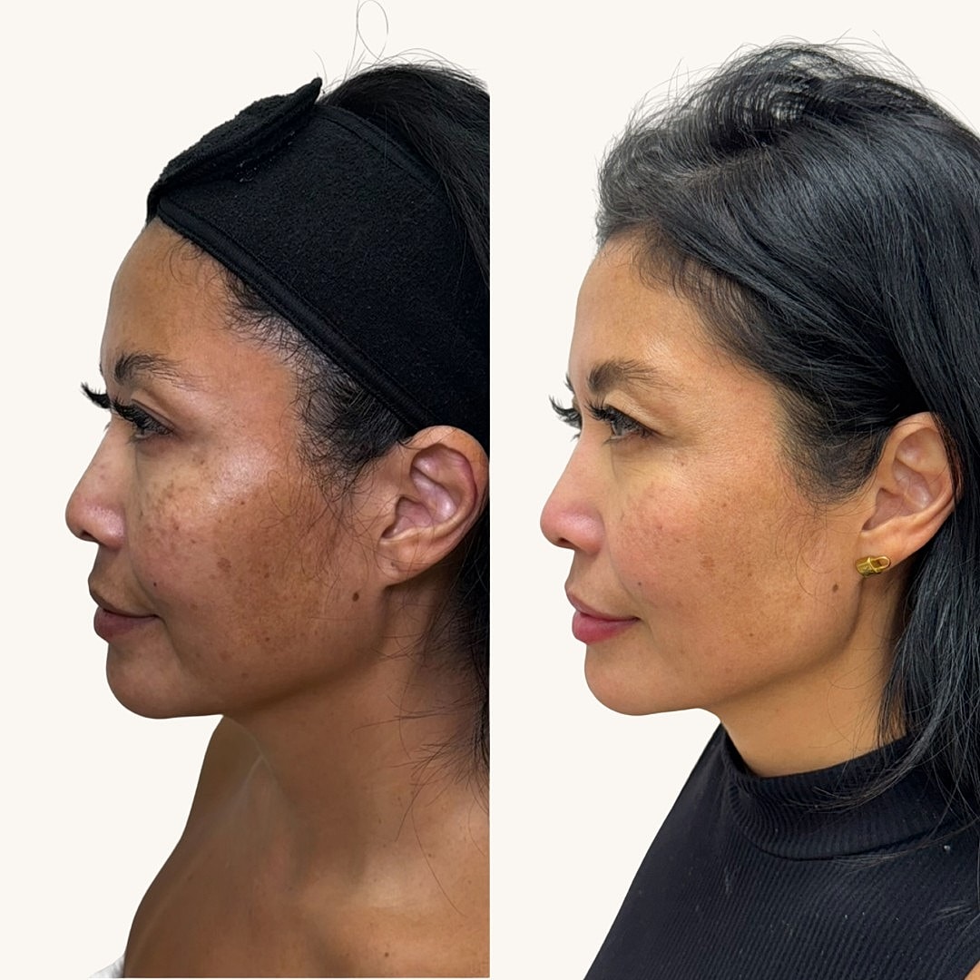 MOXI Before & After