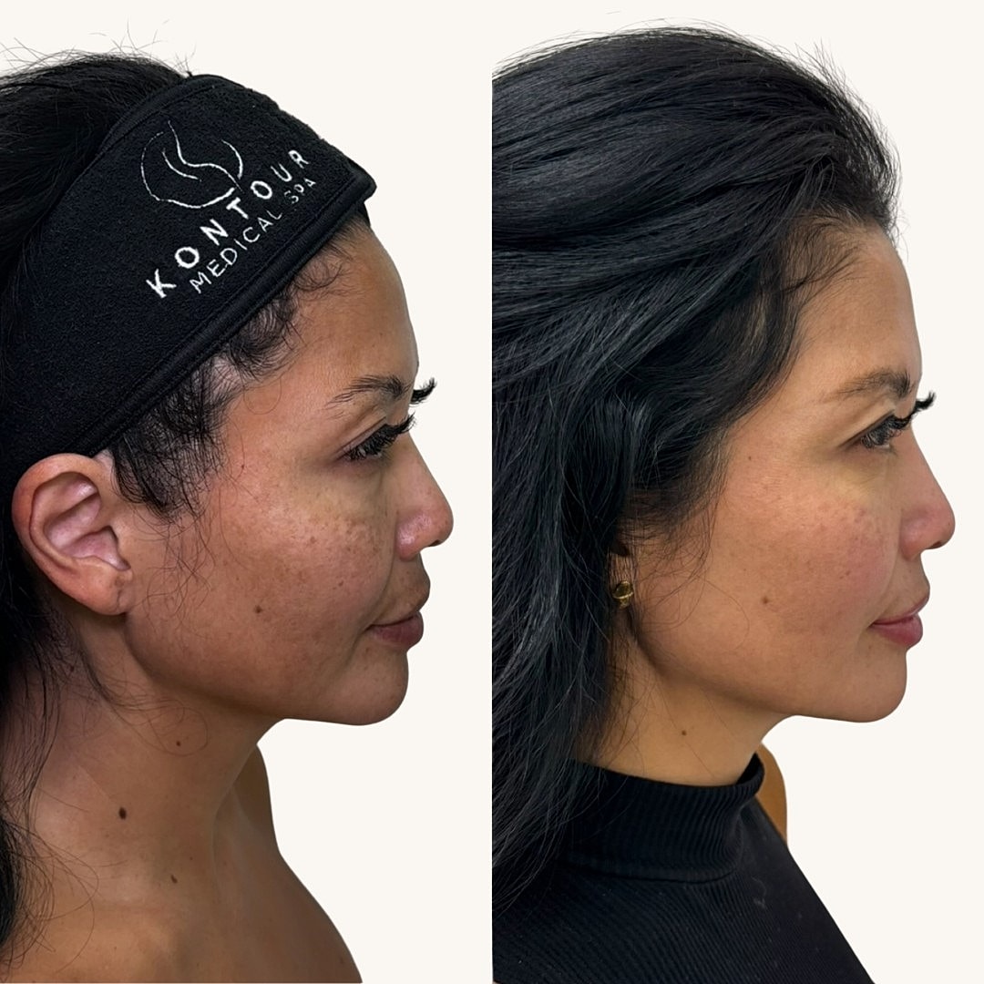 MOXI Before & After