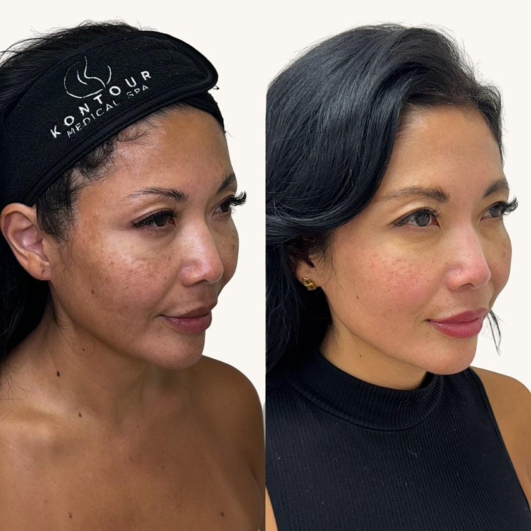 MOXI Before & After