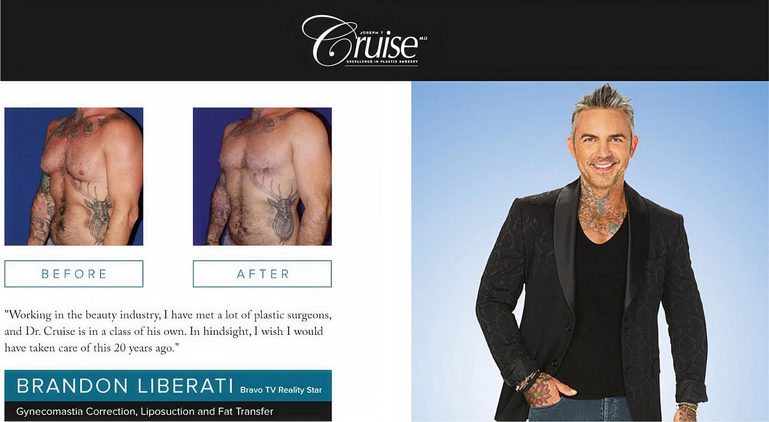 Man on beach showcasing body transformation journey.