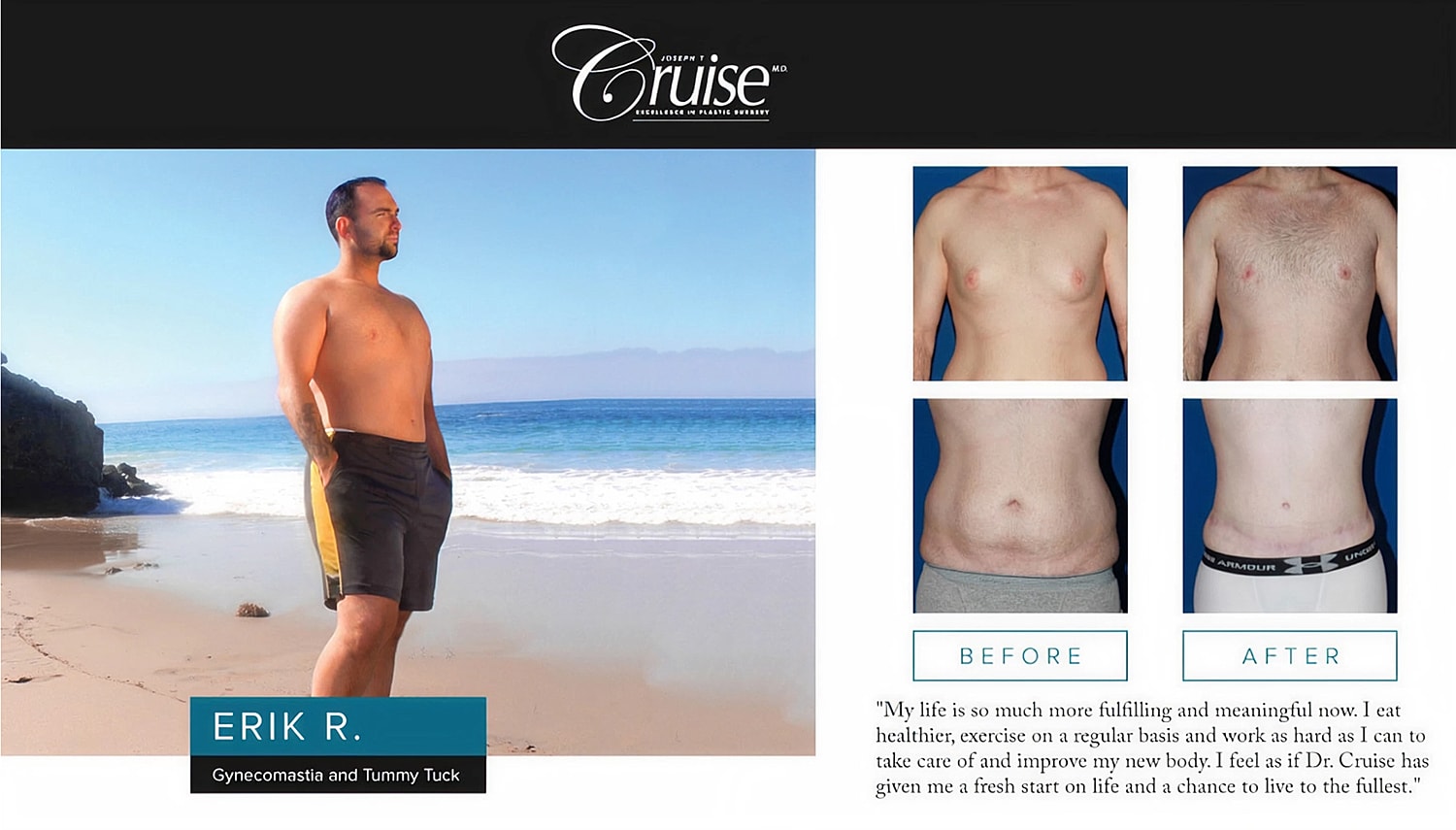 Man on beach showcasing body transformation journey.