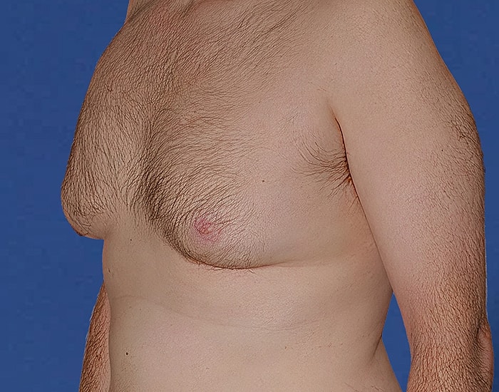 Man’s torso with hair and prominent nipple.