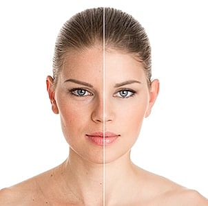 botox cosmetic coral gables