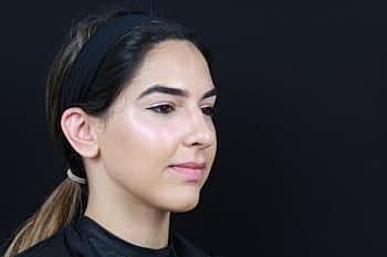 Dermal Fillers Before & After