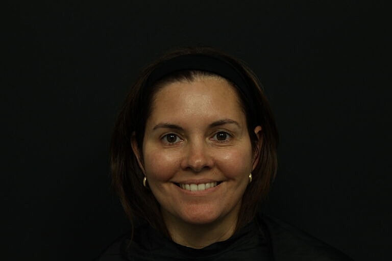 Botox & Dysport Before & After