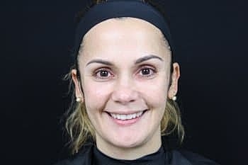 Botox & Dysport Before & After