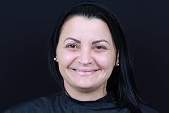 Botox & Dysport Before & After