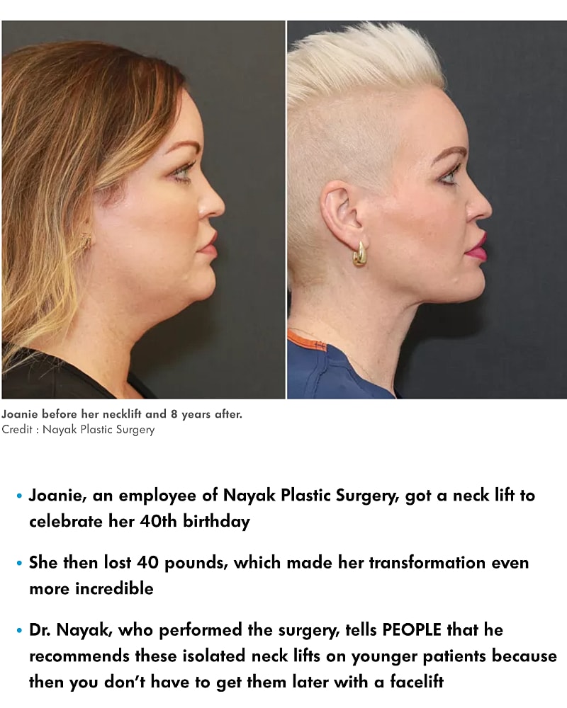 Woman Gets Transformative Neck Lift for Her 40th Birthday — and She's Unrecognizable (Exclusive)