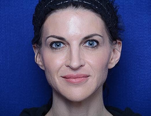 Chemical Brow Lift Before & After
