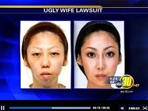 photo of mother before and after cosmetic surgery