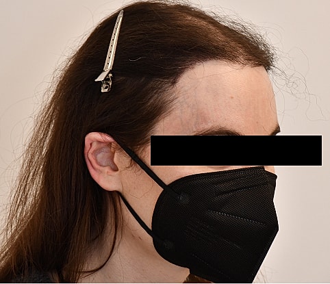 MTF Hair Gallery Before & After