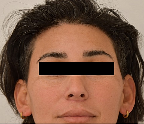 MTF Hair Gallery Before & After