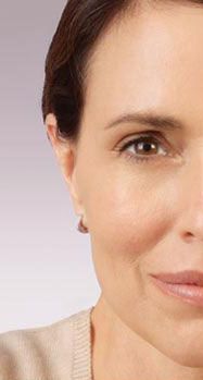 Dermal Fillers Before & After