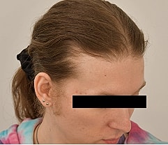 Gender Affirming Hair Before & After